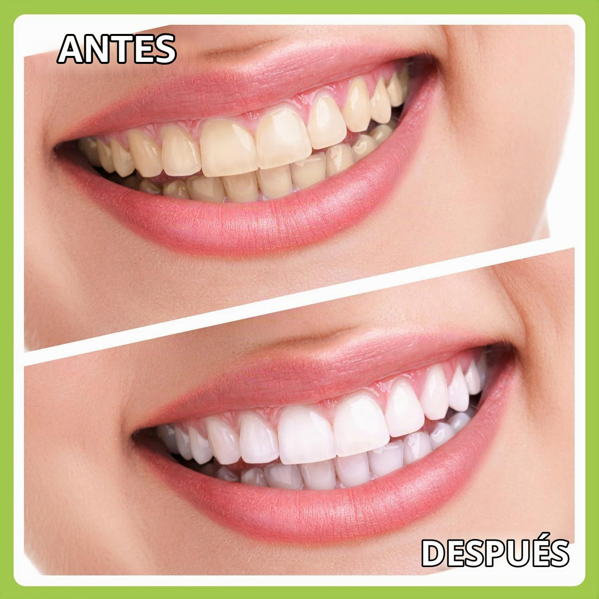 PARYUNGR Paquete de 7 herramientas dentales, kit de higiene de limp...