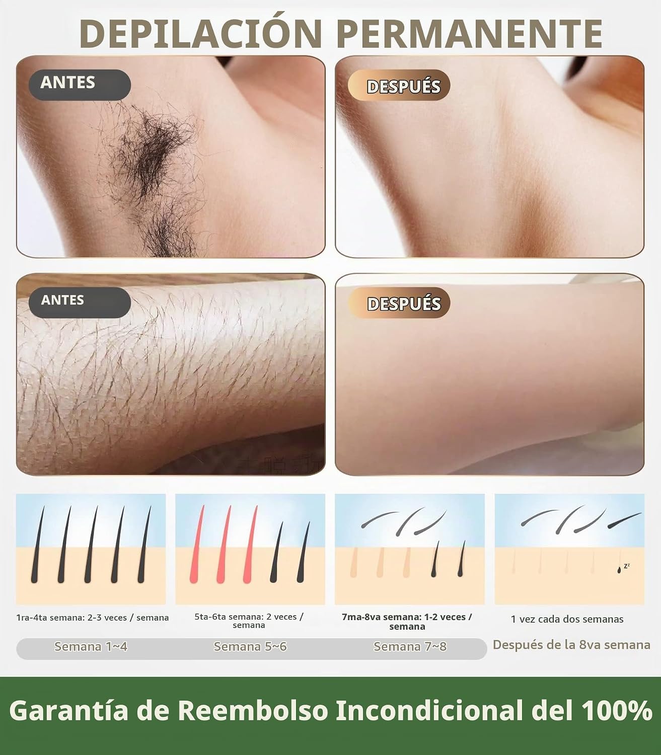 Dispositivo de depilación láser IPL para mujeres y hombres, reducci...