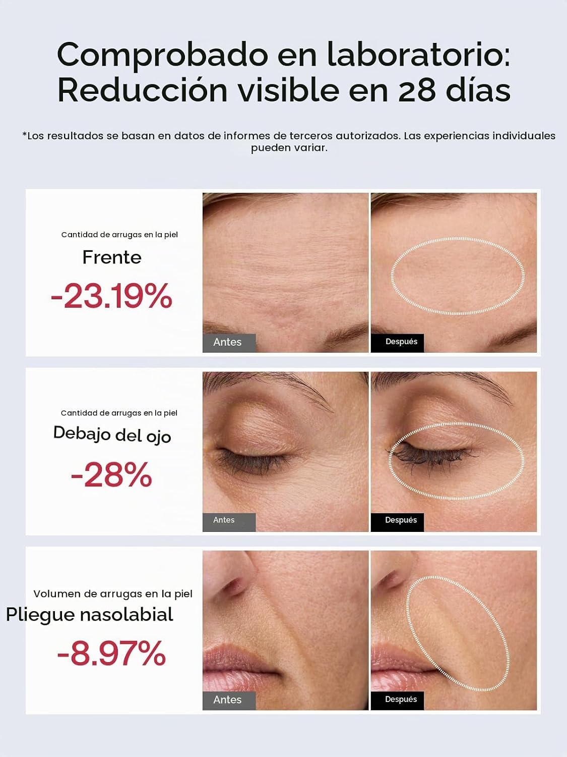 JMOON Dispositivo Facial de Microcorriente, M30U Terapia de Luz Roj...