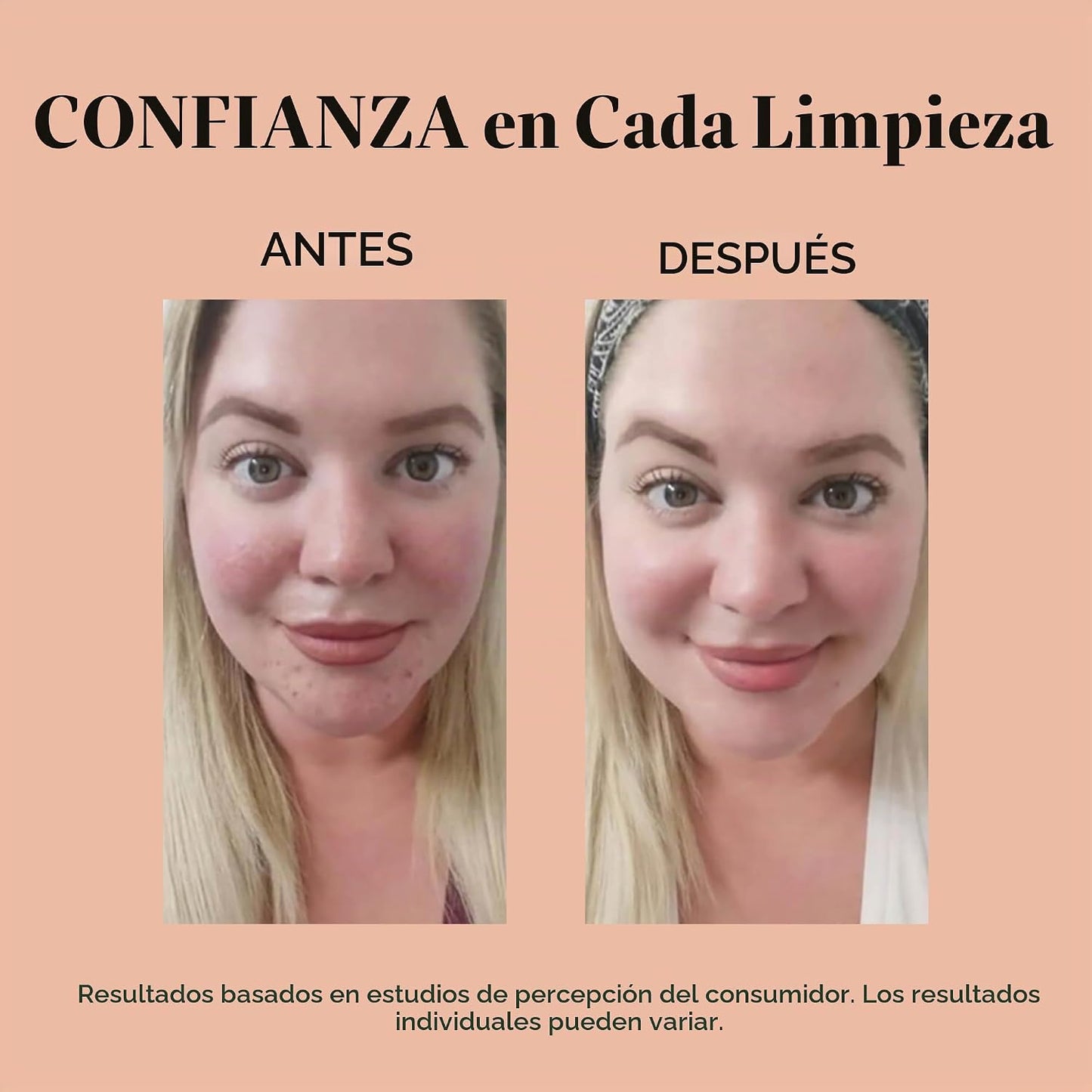 reVive Light Therapy Soniqué Mini limpiador para acné, funciona con...