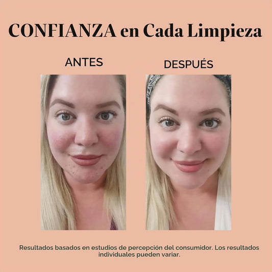 reVive Light Therapy Soniqué Mini limpiador para acné, funciona con...
