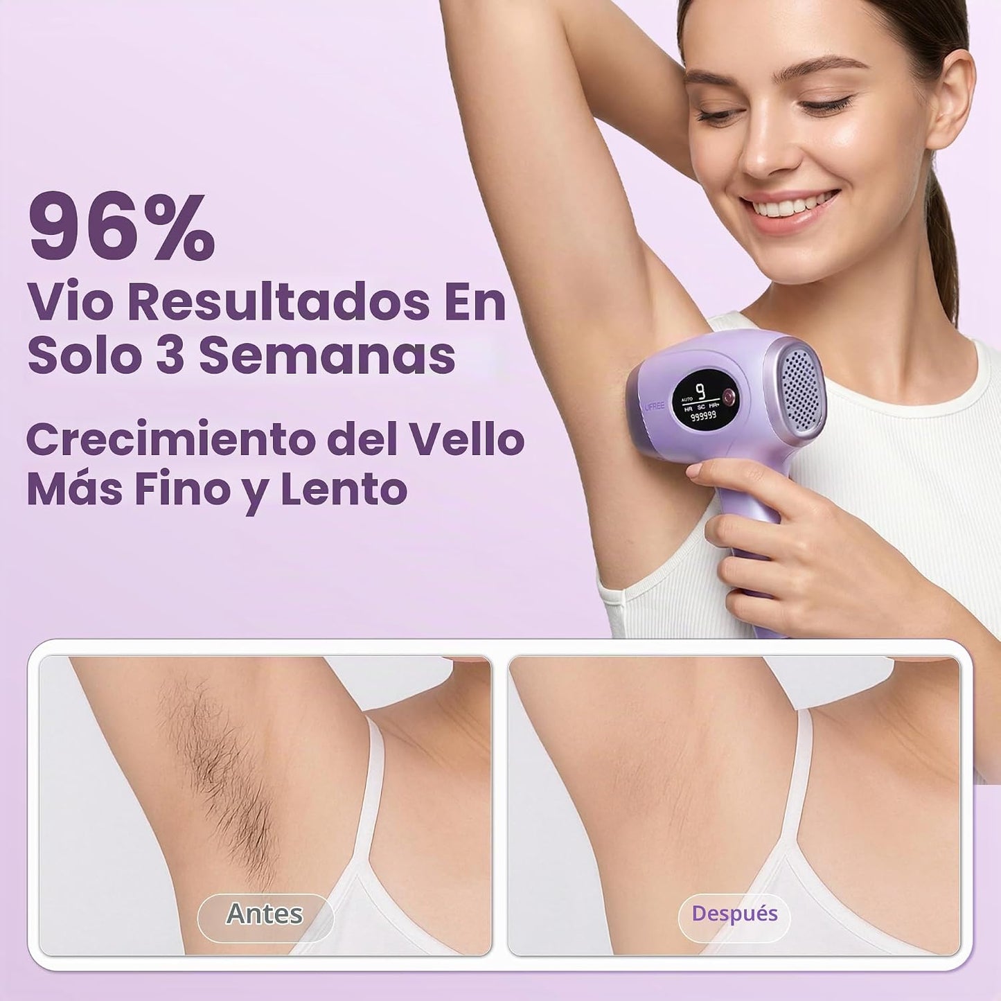 Ufree Dispositivo de depilación IPL, cuerpo completo para mujeres y...