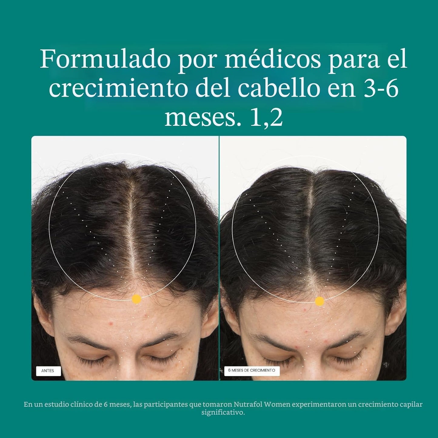 Nutrafol - Suplementos de crecimiento del cabello para mujeres, eda...
