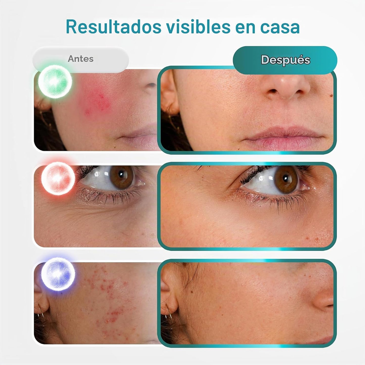 BluMora Terapia de luz roja para cara, terapia de luz LED inalámbri...
