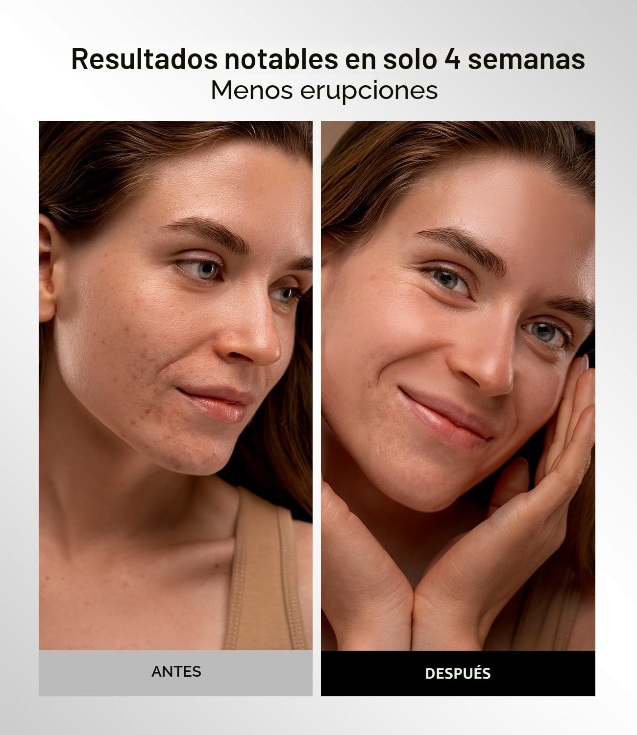 INIA Máscara de terapia de luz roja para cara, 4 modos de luz con N...