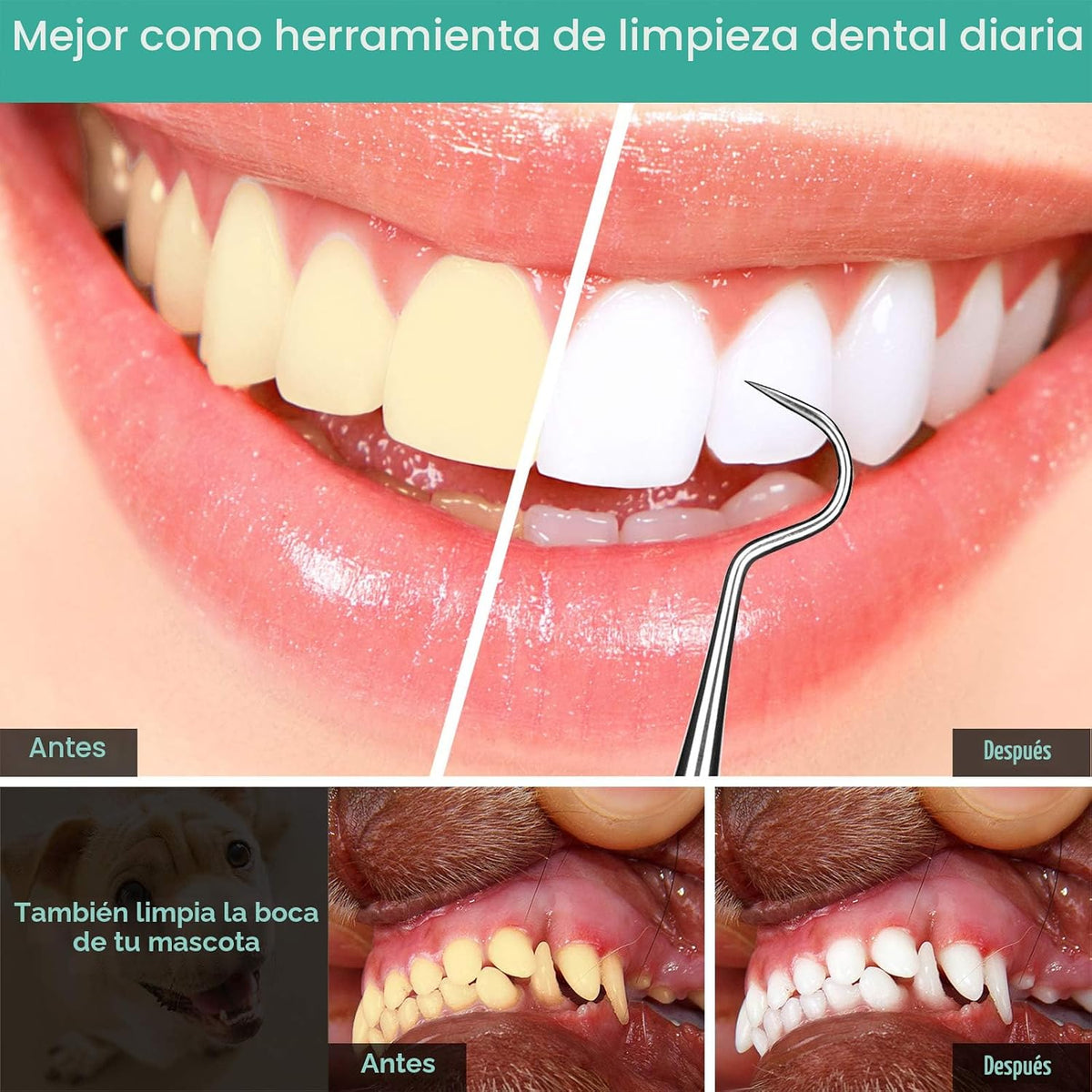 Herramienta Profesional de Raspado Dental - Palillo Dental, Acero I...