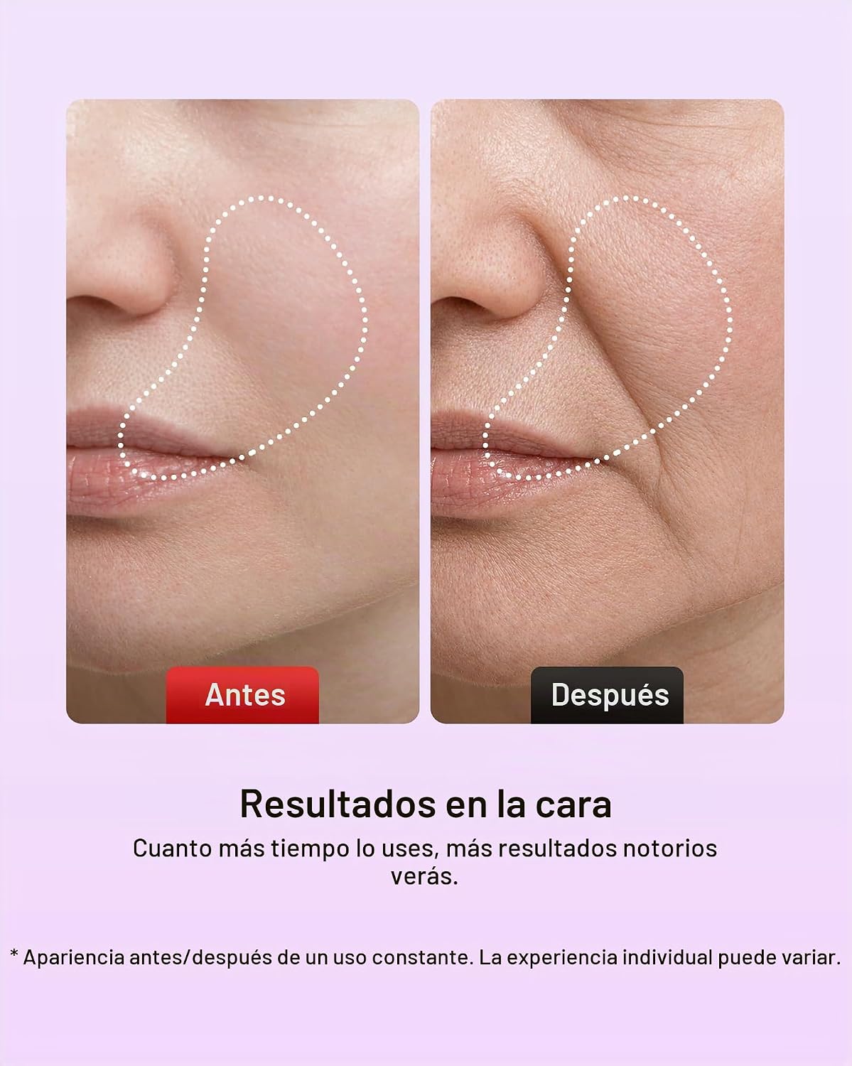 Pedete Masajeador facial, terapia de luz roja de 7 colores para car...