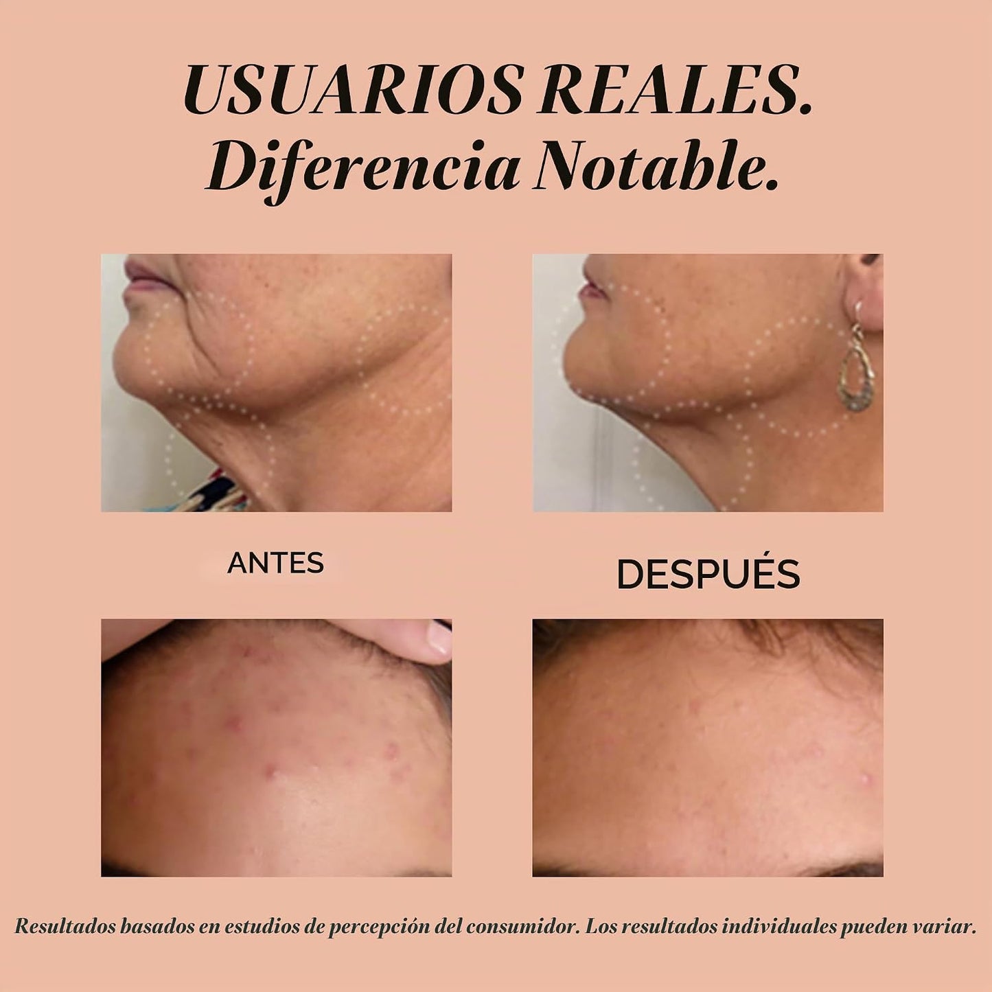 reVive Light Therapy Lux Collection Soniqué Limpiador, Cepillo Limp...
