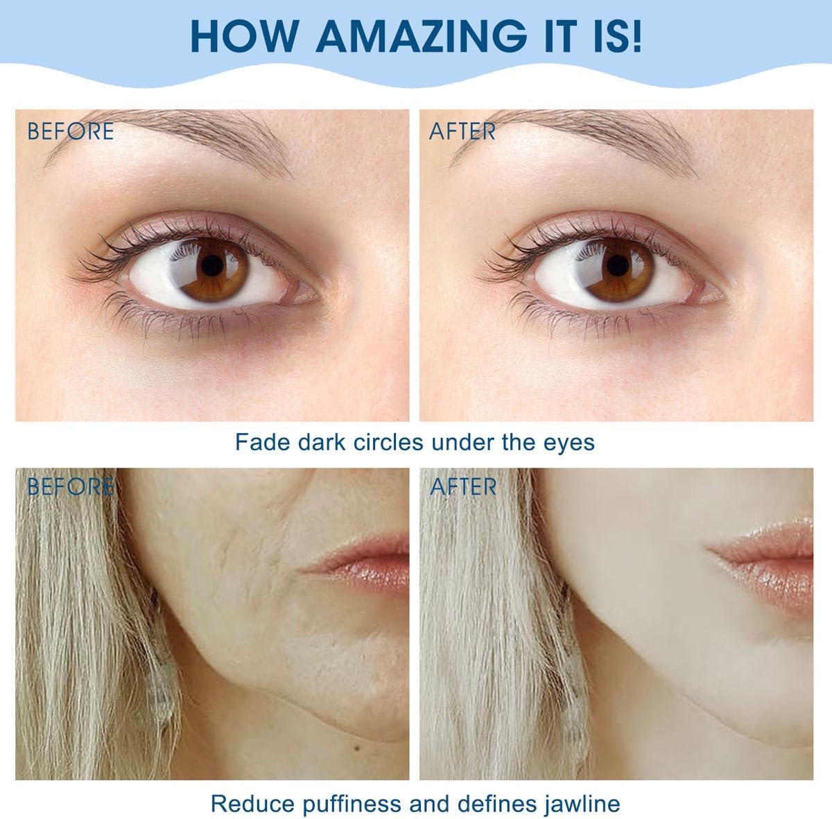 Bealihelp Rodillo Facial y Gua Sha, Rodillo Facial de Acero Inoxida...