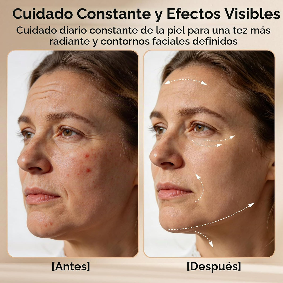 Dispositivo de belleza facial de microcorriente, terapia de luz roj...
