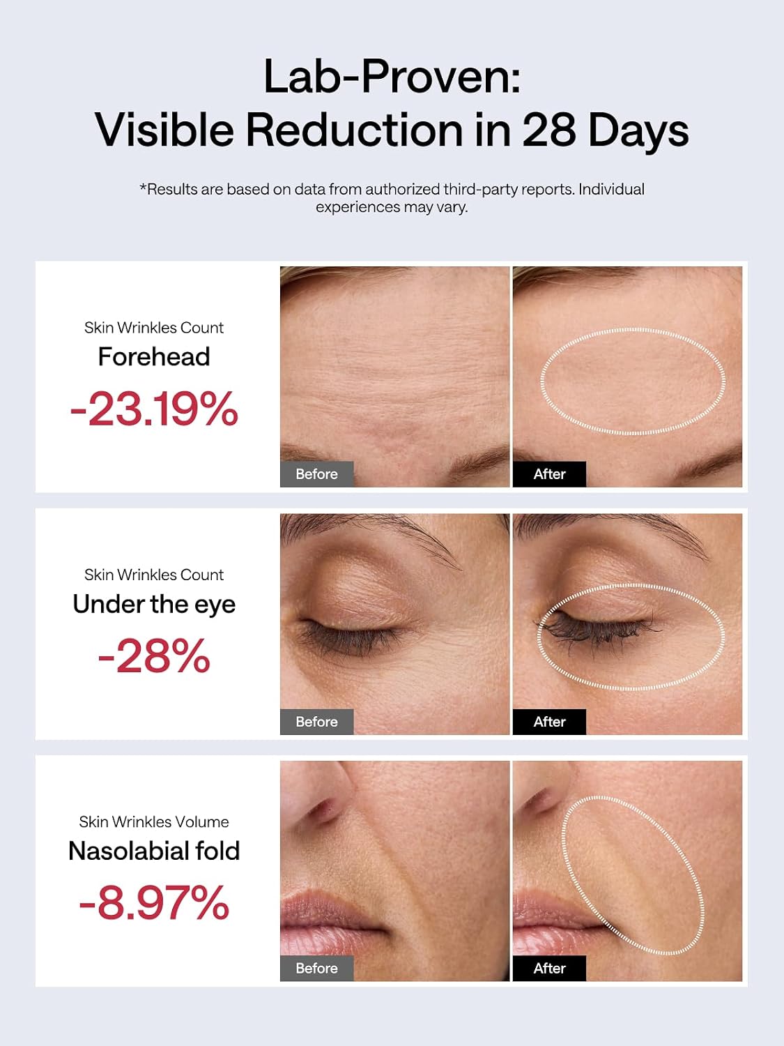 JMOON Dispositivo Facial de Microcorriente, M30U Terapia de Luz Roj...
