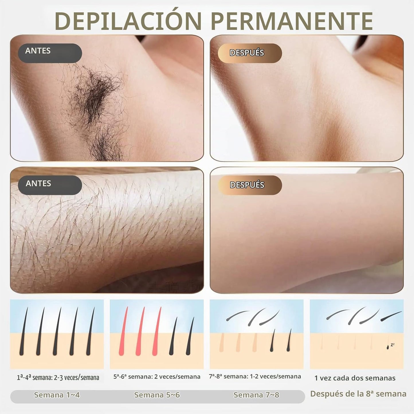 Dispositivo de depilación láser IPL para mujeres y hombres, removed...