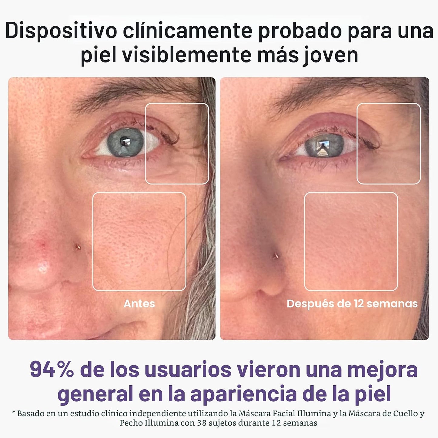 iRestore Máscara facial LED para piel juvenil, terapia de luz roja...