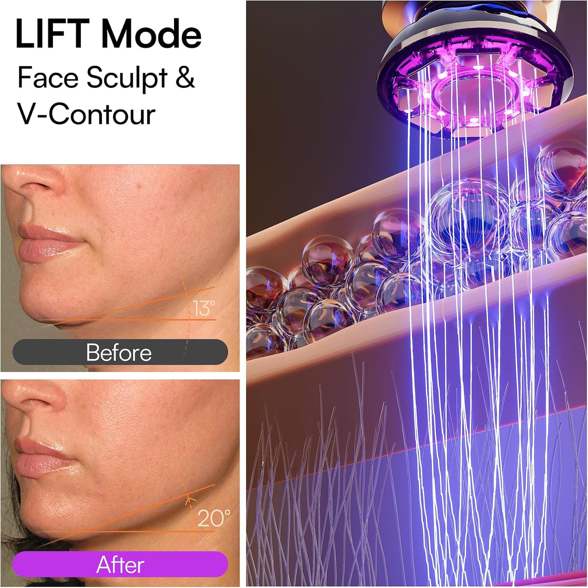 INIA Flare 3-en-1 dispositivo de belleza facial microcorriente de l...