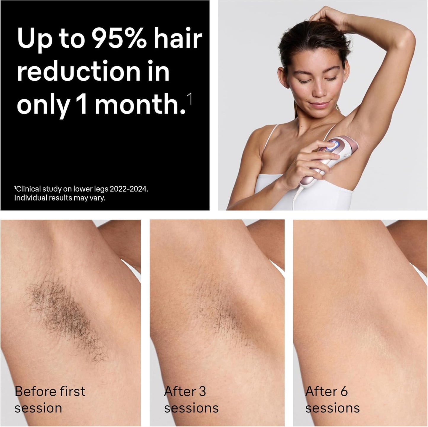 Braun Smart IPL, el mejor dispositivo de depilación de Vogue, Skin...