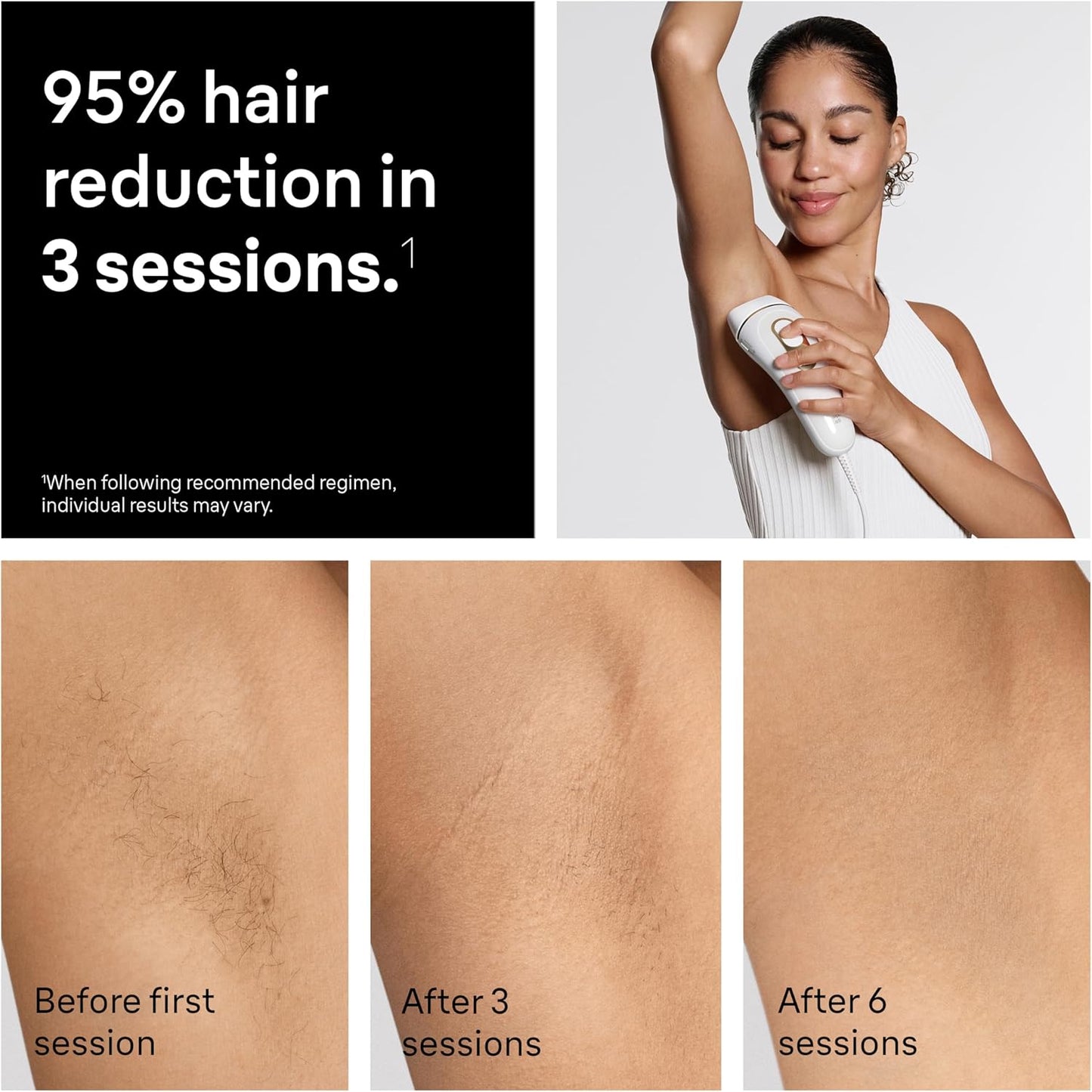 Braun IPL, Seda·Expert Pro 5, Depilación IPL para Mujeres y Hombres...