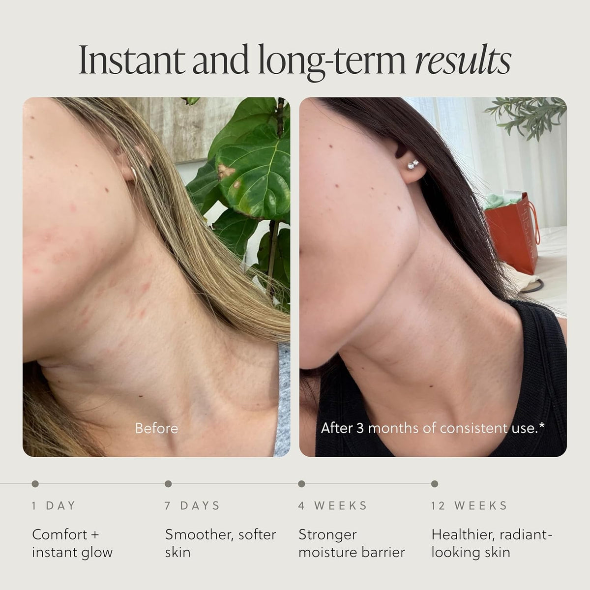 TALOVA - Rodillo facial de acero inoxidable y cara alimentada con p...