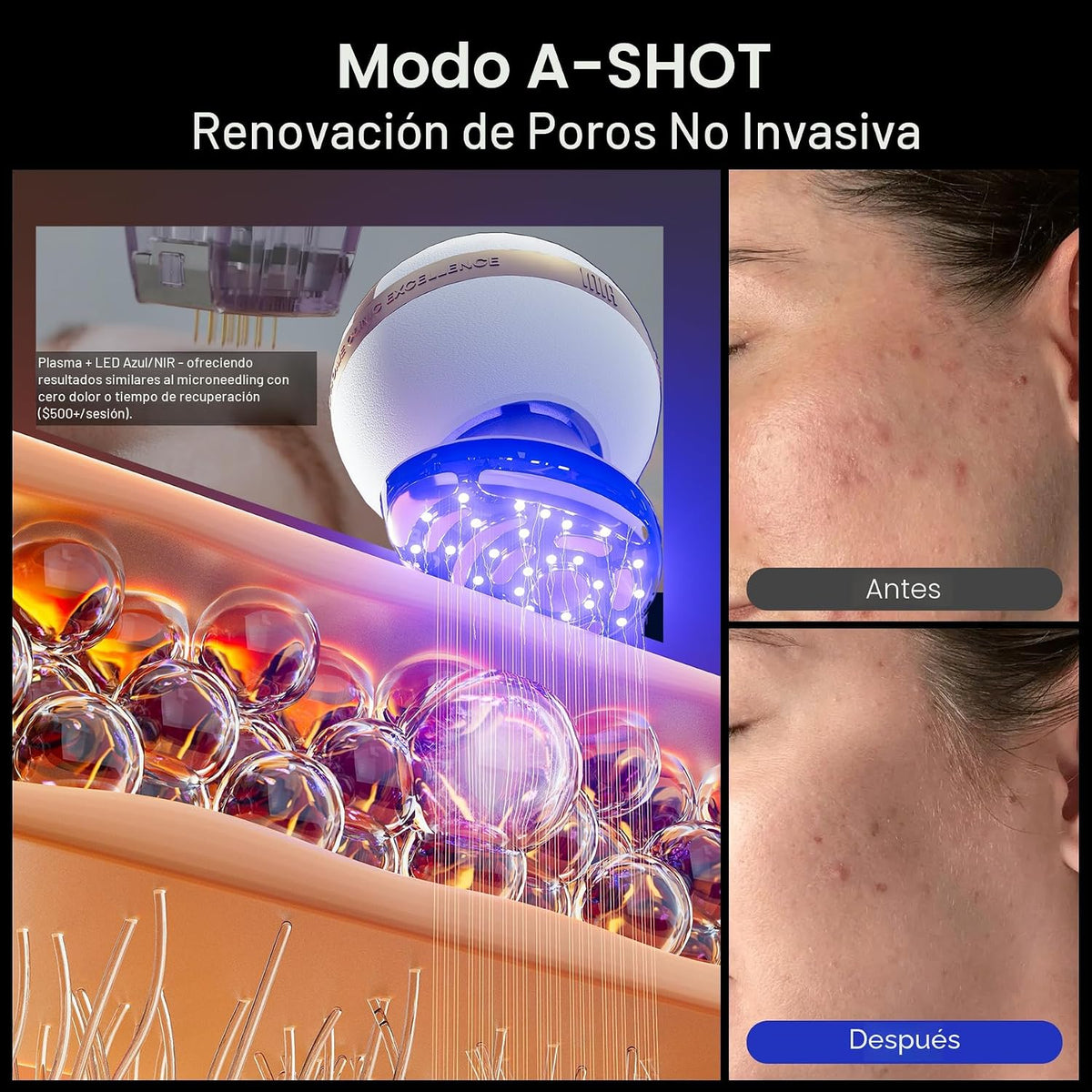 INIA SPHERA - Dispositivo facial de microcorriente 8 en 1 mejorado...