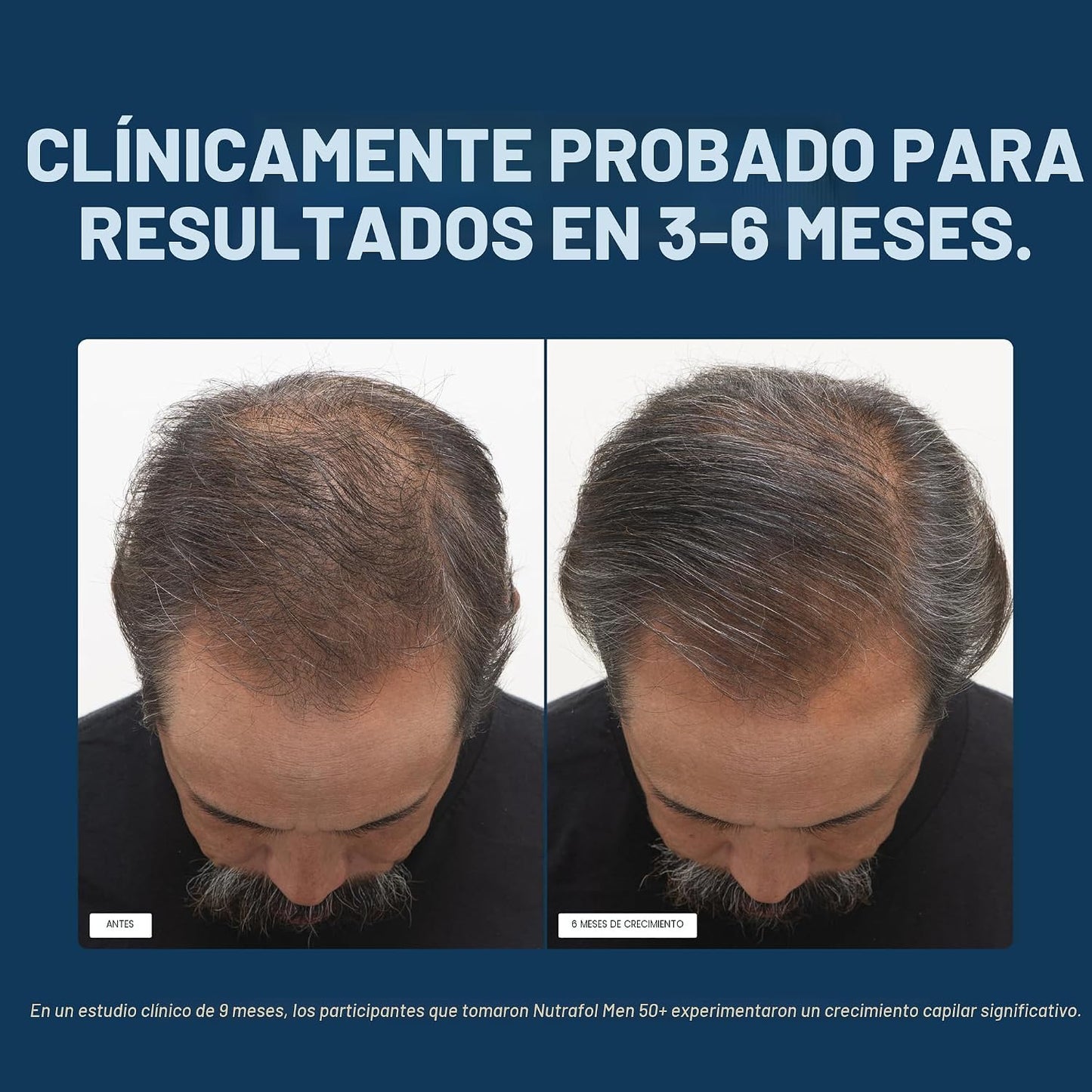 Nutrafol Men 50+ Suplementos para el crecimiento del cabello, edad...