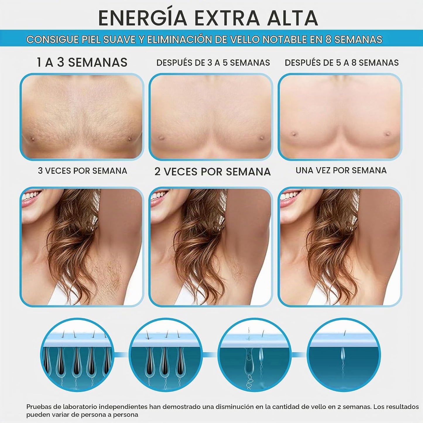 Freezing Point - Dispositivo de depilación IPL modelo W-1095 - Remo...