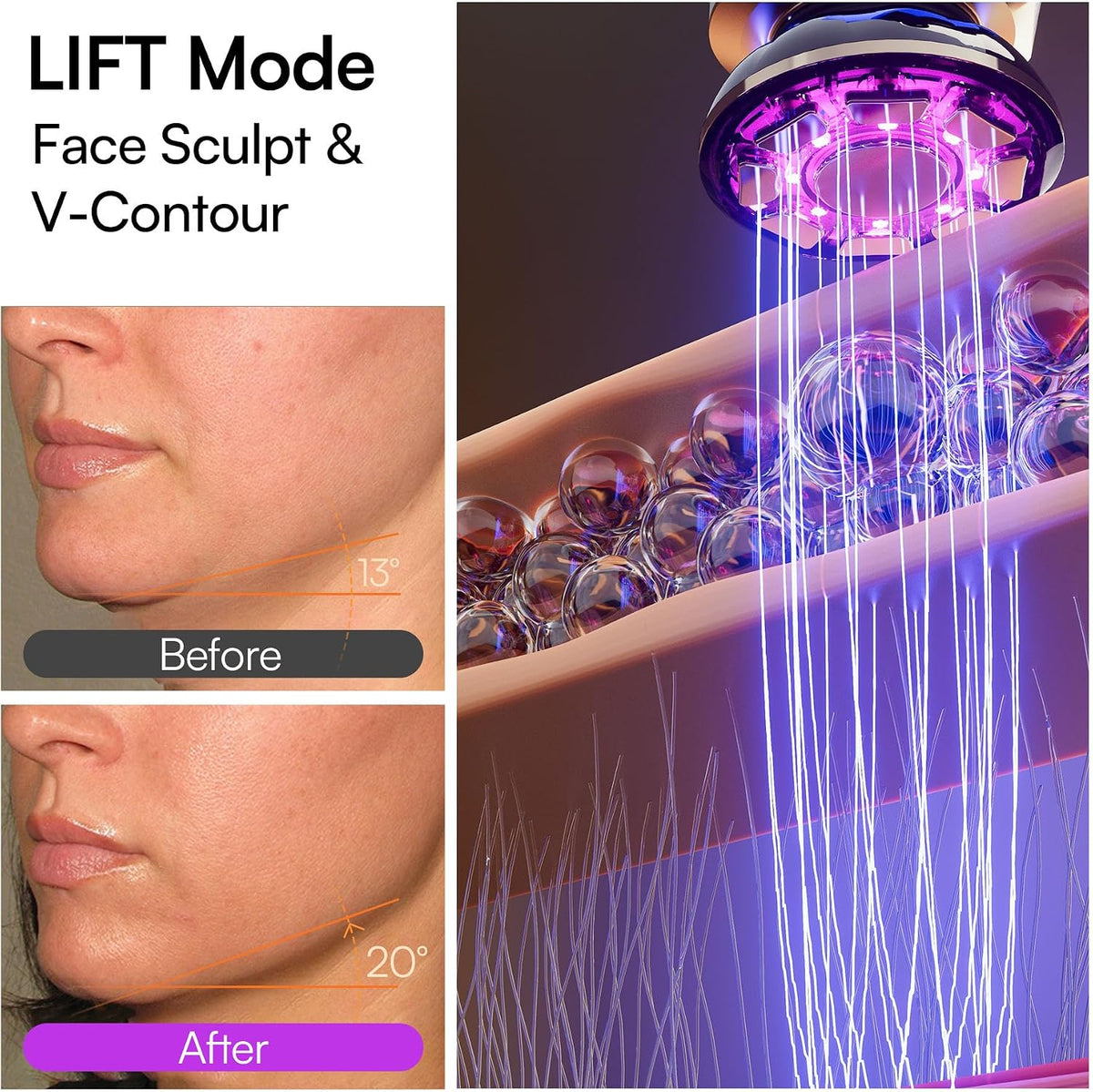 INIA FLARE - Dispositivo facial de microcorriente 3 en 1, terapia d...