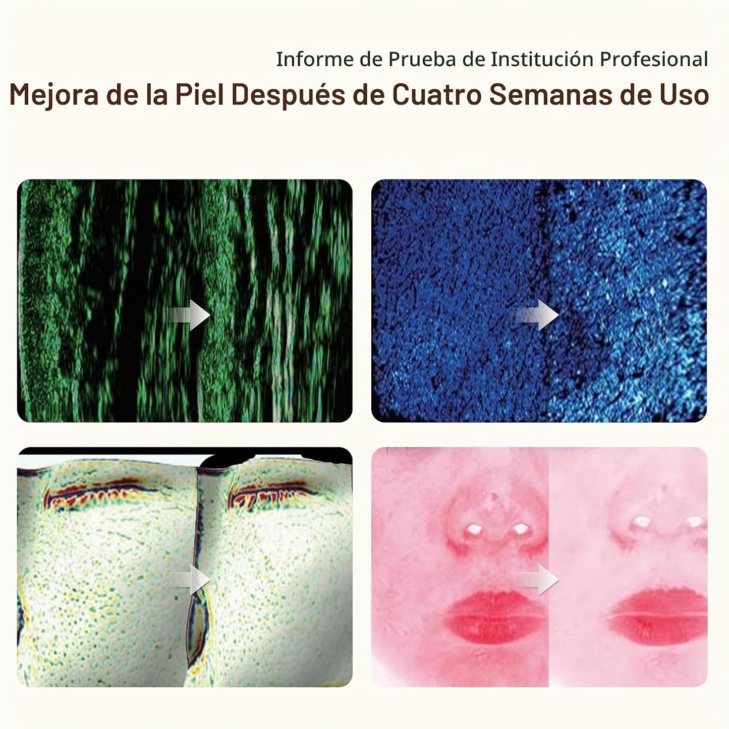 Aimilove Máscara de terapia de luz roja para cara, 850nmNIR trata e...