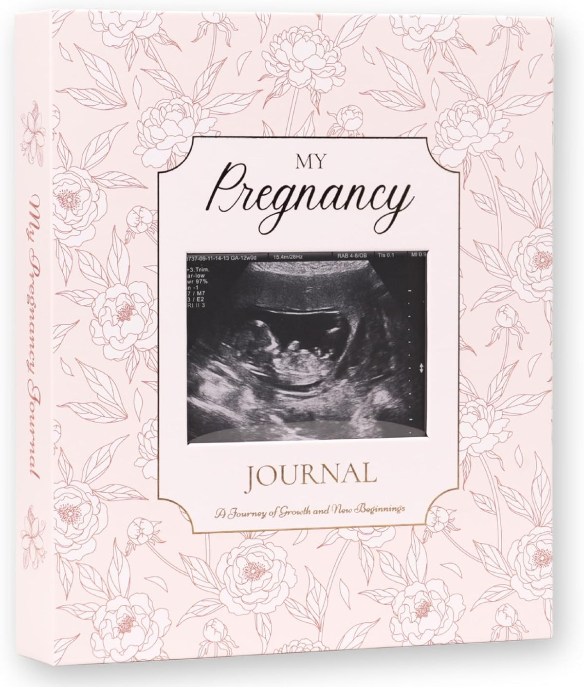 Diario de embarazo para madres primerizas, planificador de embarazo...