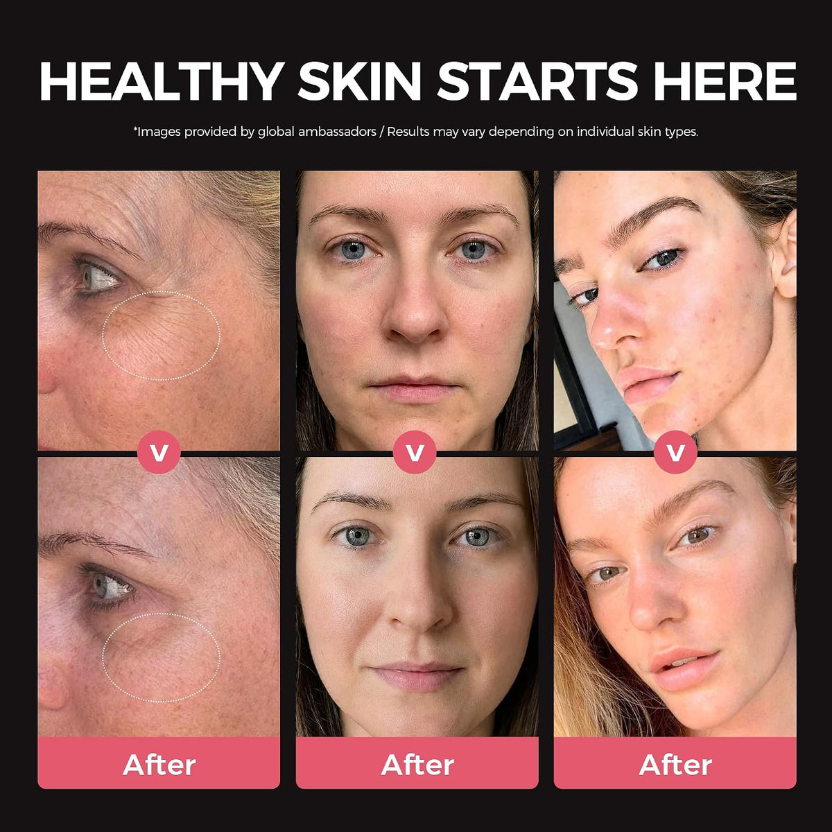 Masajeador facial, dispositivo de belleza portátil para todo tipo d...