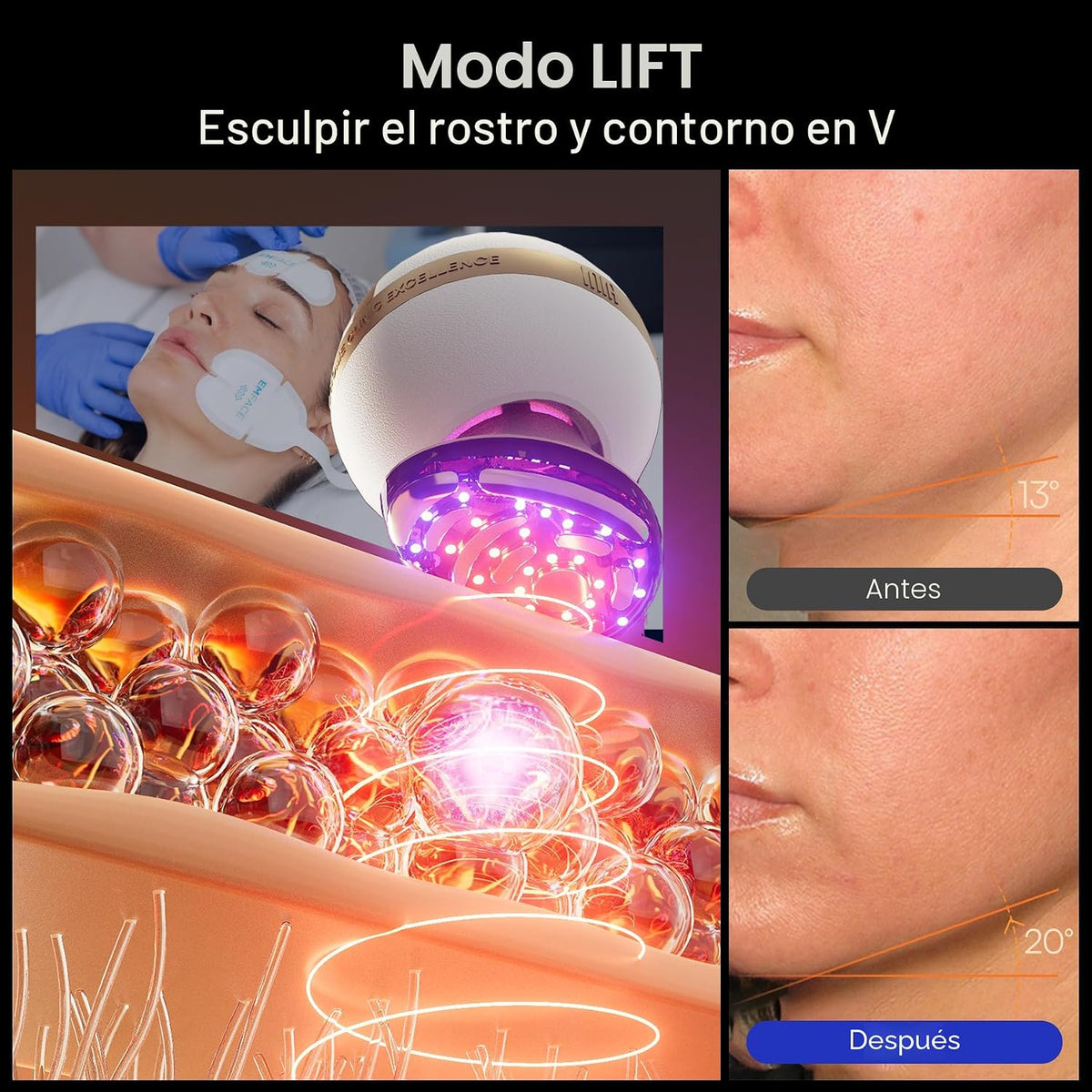 INIA SPHERA - Dispositivo facial de microcorriente 8 en 1 mejorado...