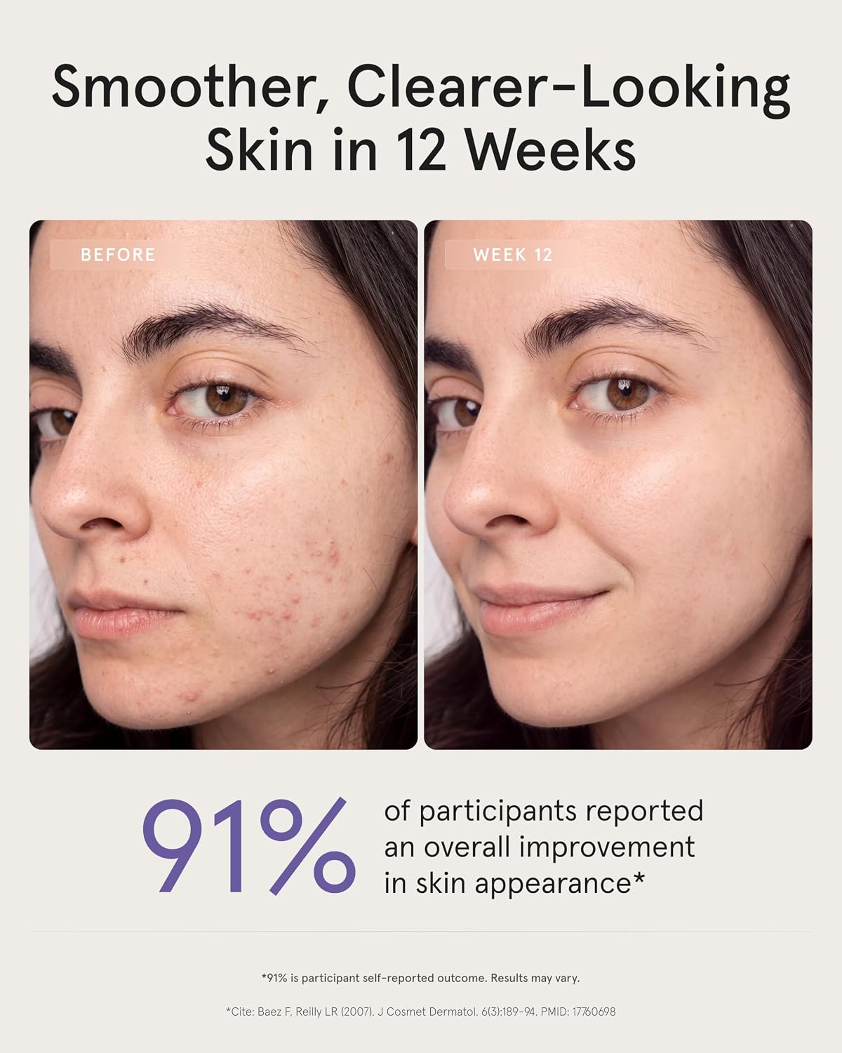 iRestore Mascarilla facial Pro, terapia de luz roja de 8 longitudes...