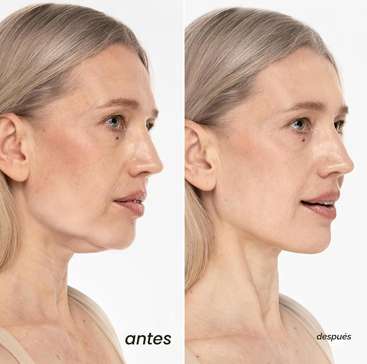 Máscara de elevación MAREE V Line - Cinta de elevación facial dorad...