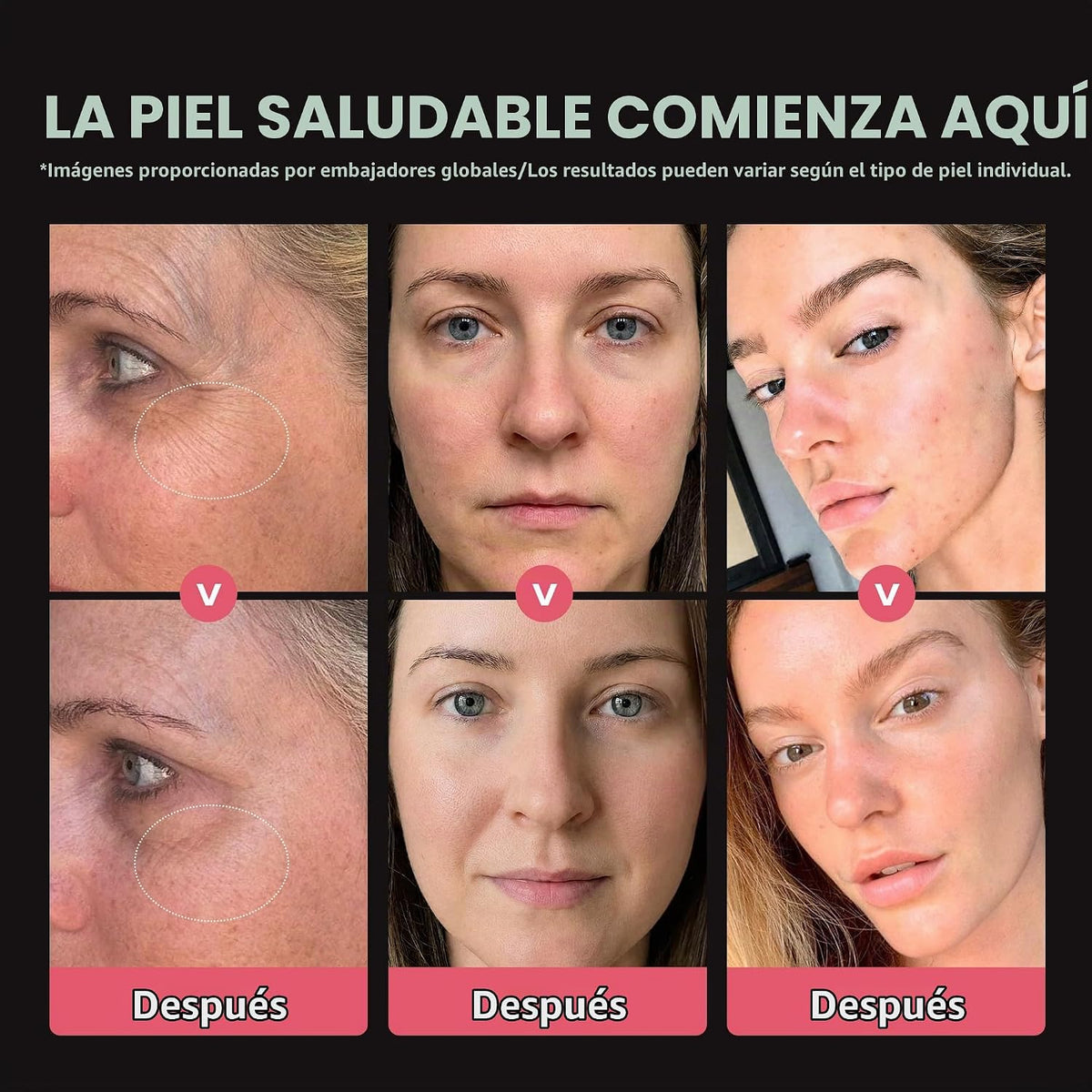 Viconor Masajeador facial, varita de luz roja 6 en 1 para mujeres p...