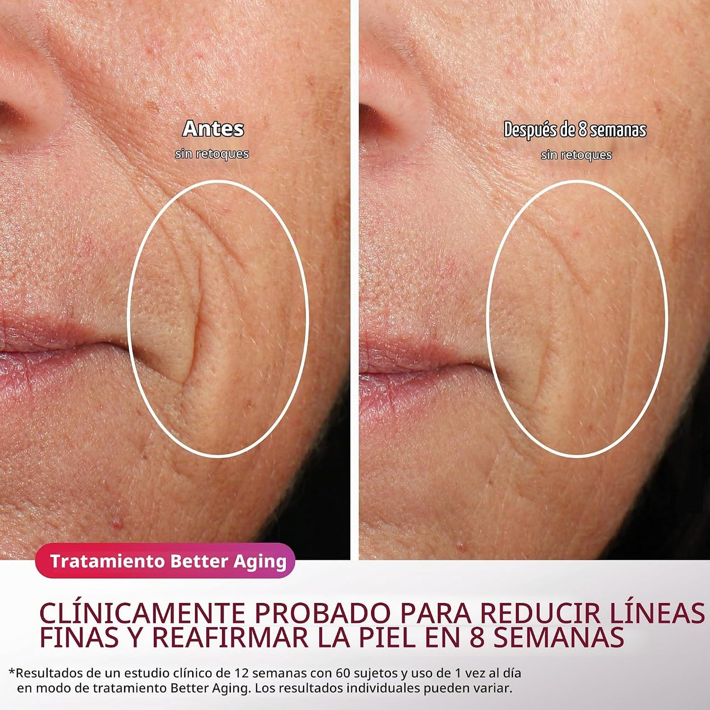 Mascarilla facial LED Shark CryoGlow con enfriamiento debajo de los...