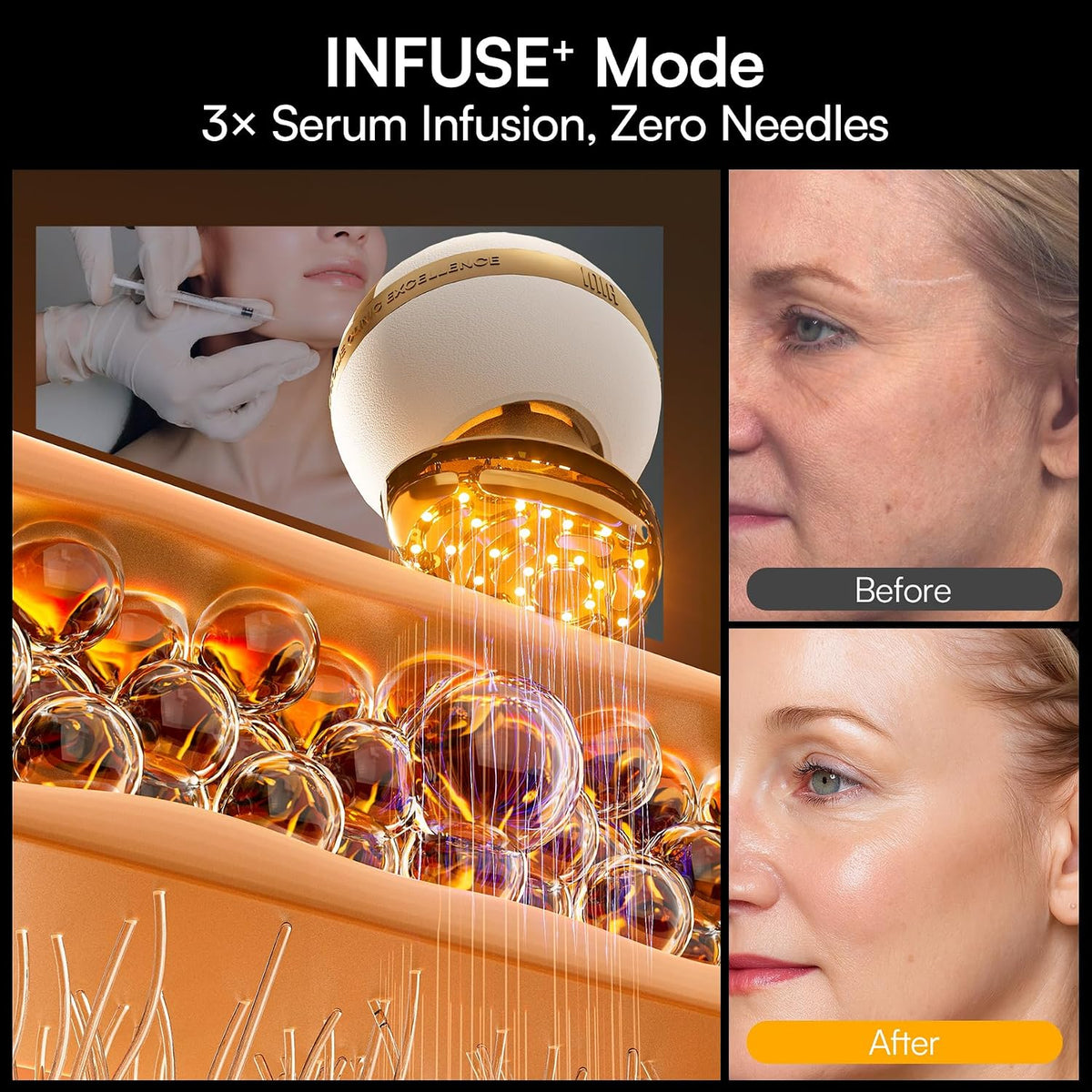 INIA SPHERA - Dispositivo facial de microcorriente 8 en 1 mejorado...