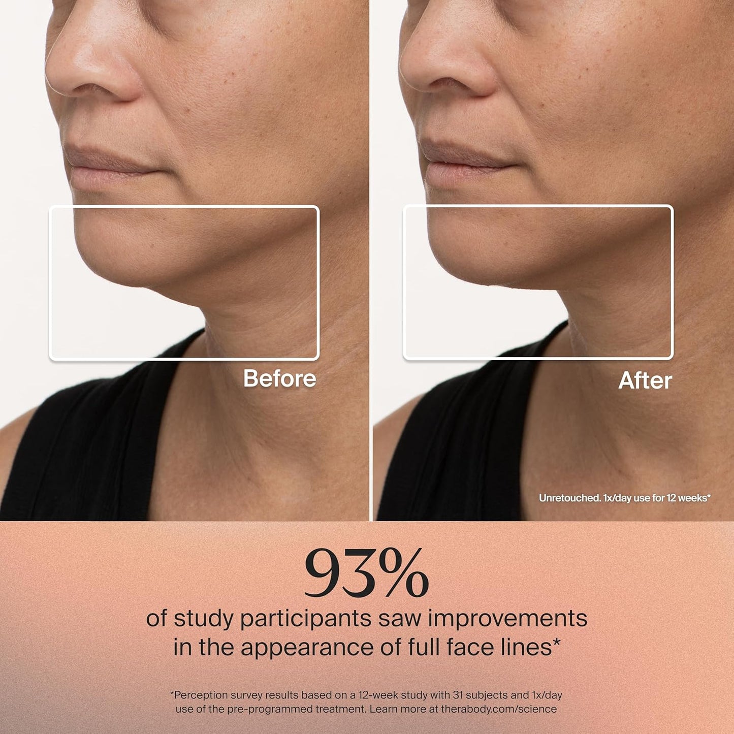 TheraFace Therabody - Máscara facial con terapia de luz LED para el...
